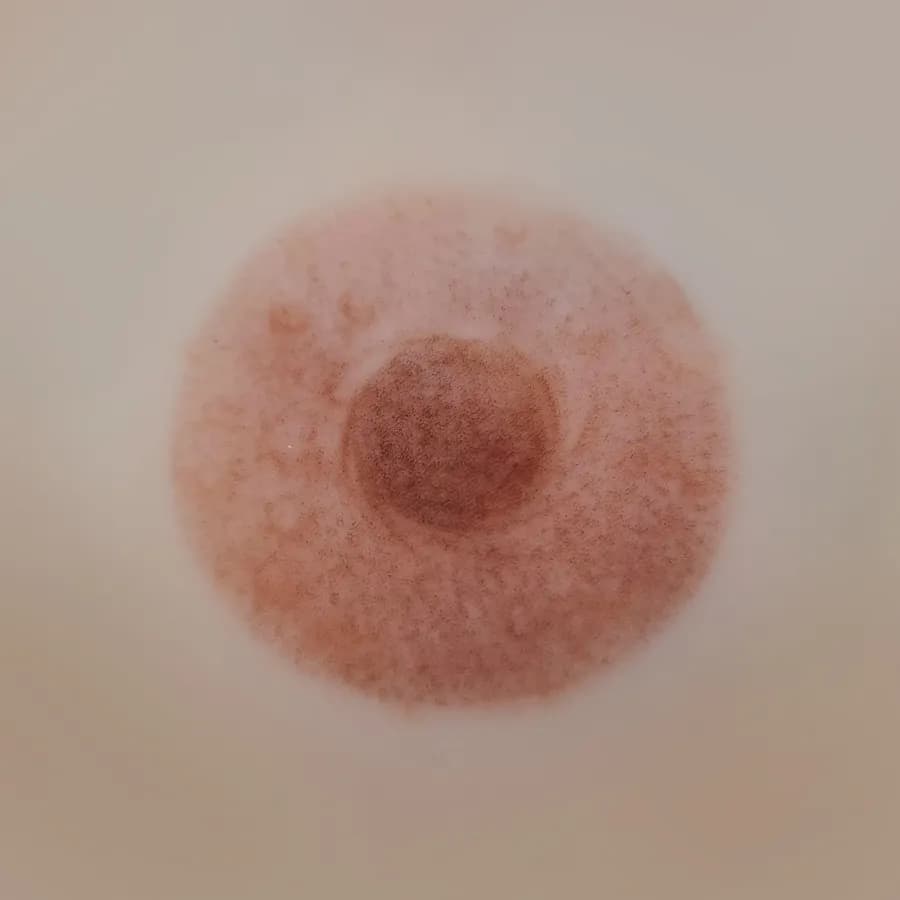 A healed areola following restorative pigmentation